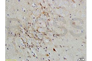 Formalin-fixed and paraffin-embedded rat brain labeled with Rabbit Anti-Versican Polyclonal Antibody, Unconjugated (ABIN741660) 1:200 followed by conjugation to the secondary antibody and DAB staining (Versican anticorps  (AA 3301-3396))