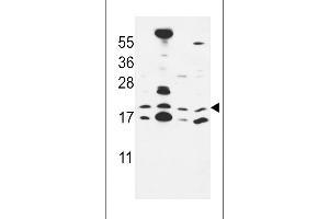 Western blot analysis in MCF-7,NCI-H460,HepG2,Hela cell line lysates (35ug/lane). (CNPY2/MSAP anticorps  (C-Term))