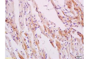 Formalin-fixed and paraffin embedded smooth muscle of rat stomach labeled with Anti-Phospho-HSP27(Ser78) Polyclonal Antibody, Unconjugated (ABIN685303) at 1:200 followed by conjugation to the secondary antibody and DAB staining (HSP27 anticorps  (pSer78))