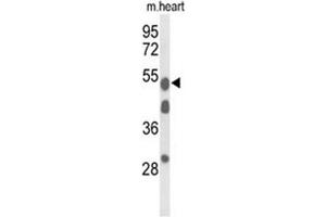 Western blot analysis of A1BG Antibody (Center) in mouse heart tissue lysates (35 µg/lane).