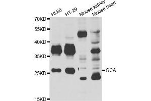 Western blot analysis of extracts of various cell lines, using GCA antibody (ABIN5974261) at 1/1000 dilution. (Grancalcin anticorps)