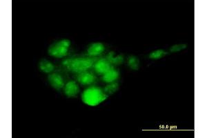 Immunofluorescence of monoclonal antibody to PSMD14 on A-431 cell.