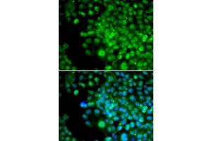 Immunofluorescence analysis of HeLa cells using FHL1 antibody (ABIN5973173). (FHL1 anticorps)
