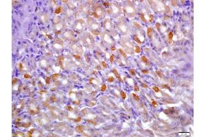 Formalin-fixed and paraffin embedded mouse stomach labeled with Anti-phospho-CaMK2 alpha (Tyr231) Polyclonal Antibody, Unconjugated (ABIN683848) at 1:200 followed by conjugation to the secondary antibody and DAB staining (CAMK2B anticorps  (pTyr230))