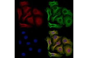 ABIN6264603 and ABIN6276542 staining Hela cells by IF/ICC.