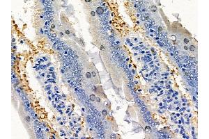 ABIN6260015 and ABIN6277901 at 1/100 staining rat colorectal tissue by IHC-P.