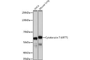 Western blot analysis of extracts of various cell lines, using Cytokeratin 7 (KRT7) (KRT7) Rabbit mAb  at 1:1000 dilution. (Cytokeratin 7 anticorps)