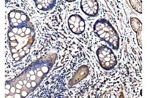 IHC analysis of HSPA6 using anti-HSPA6 antibody (ABIN7601944). (HSPA6 anticorps  (AA 516-643))