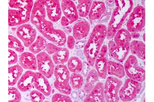 Anti-CXCL12 antibody IHC of human kidney, tubules.