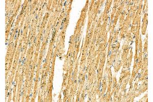 ABIN6265015 and ABIN6277239 at 1/100 staining Rat heart tissue by IHC-P. (SERPINH1 anticorps  (Internal Region))