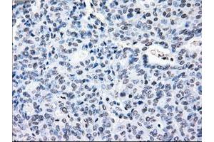 Image no. 2 for anti-Crystallin, alpha B (CRYAB) antibody (ABIN1497647)