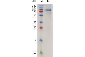 Human Q Protein, His Tag on SDS-PAGE under reducing condition.