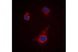 Immunofluorescent analysis of ATG4C staining in K562 cells. (ATG4C anticorps  (N-Term))