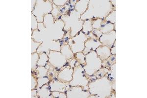 (ABIN657832 and ABIN2846797) staining Mouse Csf1r in mouse lung tissue sections by Immunohistochemistry (IHC-P - paraformaldehyde-fixed, paraffin-embedded sections). (CSF1R anticorps  (C-Term))