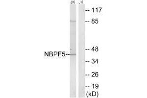 Western blot analysis of extracts from Jurkat cells, using NBPF5 antibody. (NBPF5 anticorps  (C-Term))