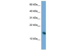 Western Blot showing PAIP2 antibody used at a concentration of 1.