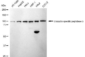 Western blotting analysis using Ubiquitin specific peptidase 5 antibody (ABIN7800737). (Recombinant USP5 anticorps)