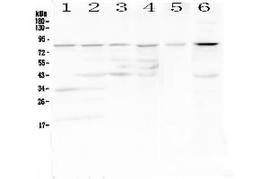Western blot analysis of CD19 using anti-CD19 antibody . (CD19 anticorps  (AA 19-237))