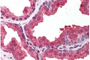 Human Prostate: Formalin-Fixed, Paraffin-Embedded (FFPE) (DYRK1A anticorps  (AA 22-71))