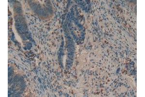 Used in DAB staining on fromalin fixed paraffin- embedded liver tissue (Biglycan anticorps  (AA 243-369))