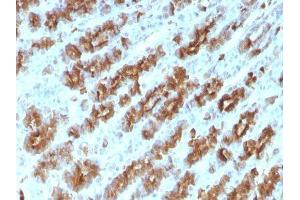 Image no. 2 for anti-Tumor Necrosis Factor alpha (TNF alpha) antibody (ABIN6171941) (TNF alpha anticorps)