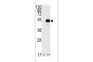 Western blot analysis of TP53(arrow) using rabbit polyclonal p53 Antibdoy (T55) (ABIN390200 and ABIN2840687). (p53 anticorps  (AA 33-62))