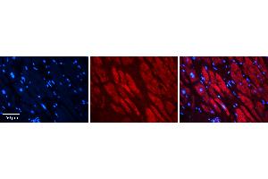 Rabbit Anti-RAD23B Antibody Catalog Number: ARP56505_P050 Formalin Fixed Paraffin Embedded Tissue: Human heart Tissue Observed Staining: Cytoplasmic Primary Antibody Concentration: 1:100 Other Working Concentrations: N/A Secondary Antibody: Donkey anti-Rabbit-Cy3 Secondary Antibody Concentration: 1:200 Magnification: 20X Exposure Time: 0. (RAD23B anticorps  (Middle Region))