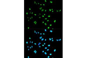 Immunofluorescence analysis of A549 cells using PAX2 antibody (ABIN1874046). (PAX2A anticorps)