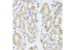 Immunohistochemistry of paraffin-embedded human stomach using MIP antibody (ABIN3016917, ABIN3016918, ABIN3016919 and ABIN6219879) at dilution of 1:100 (40x lens). (Mip (AA 50-150) anticorps)