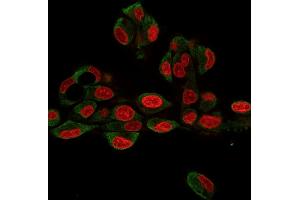 anti-Heat Shock Protein 90kDa beta (Grp94), Member 1 (HSP90B1) antibody