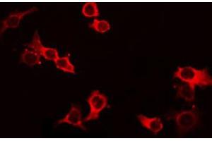 ABIN6268688 staining HeLa by IF/ICC. (IL-4 anticorps  (Internal Region))