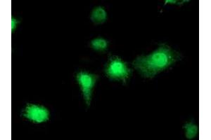 Immunofluorescence (IF) image for anti-Eukaryotic Translation Initiation Factor 2B, Subunit 3 Gamma, 58kDa (EIF2B3) antibody (ABIN1497967)