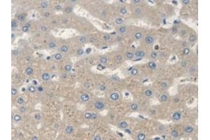 Detection of SCARA5 in Human Liver Tissue using Polyclonal Antibody to Scavenger Receptor Class A Member 5 (SCARA5) (SCARA5 anticorps  (AA 118-495))