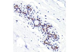 Immunohistochemistry of paraffin-embedded human breast using CDKN1B/p27KIP1 Rabbit mAb (ABIN7266602) at dilution of 1:100 (40x lens). (CDKN1B anticorps)