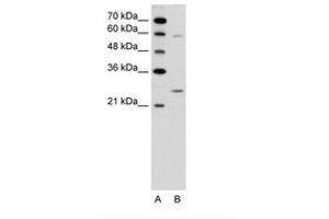 Image no. 1 for anti-Guanidinoacetate N-Methyltransferase (GAMT) (N-Term) antibody (ABIN6736619) (GAMT anticorps  (N-Term))