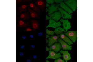 ABIN6257185 and ABIN6274308 staining Hela cells by IF/ICC. (Foxk1 anticorps  (Internal Region))