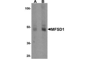 Western blot analysis of MFSD1 in human lung tissue lysate with MFSD1 antibody at (A) 1 and (B) 2 μg/ml. (MFSD1 anticorps  (Center))
