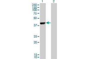 Western Blot analysis of CAMK1D expression in transfected 293T cell line by CAMK1D monoclonal antibody (M10), clone 3H8. (CAMK1D anticorps  (AA 1-95))