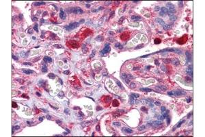 Human Placenta: Formalin-Fixed, Paraffin-Embedded (FFPE) (GDI2 anticorps)