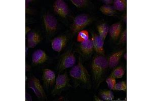 Immunofluorescence staining of methanol-fixed HeLa cells using NF-kappa,B p105/p50 (phospho-Ser337) antibody.