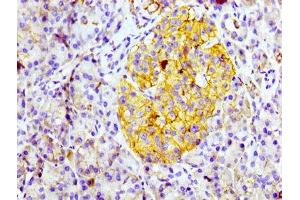 IHC image of ABIN7127288 diluted at 1:100 and staining in paraffin-embedded human pancreatic tissue performed on a Leica BondTM system.
