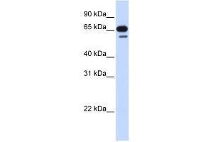 R3HDM2 antibody used at 1 ug/ml to detect target protein. (R3HDM2 anticorps  (Middle Region))