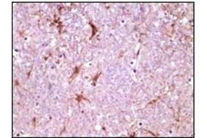 Immunohistochemistry (IHC) image for anti-Calcium and Integrin-Binding Protein 1 (CIB1) (truncated) antibody (ABIN2464036)