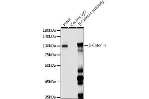 Immunoprecipitation analysis of 300 μg extracts of 293T cells using 3 μg β-Catenin antibody (ABIN6134299, ABIN6139205, ABIN6139208 and ABIN6215244).