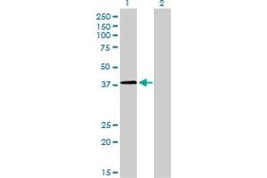 Western Blotting (WB) image for anti-Nuclear Transcription Factor Y, gamma (NFYC) (AA 14-113) antibody (ABIN6796834)