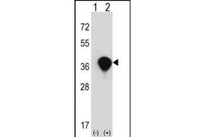 Western blot analysis of TALDO1 (arrow) using rabbit polyclonal TALDO1 Antibody (Center) (ABIN390629 and ABIN2840933). (TALDO1 anticorps  (AA 186-215))