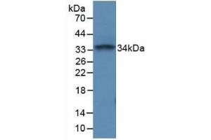 Detection of Recombinant PTPRC, Mouse using Polyclonal Antibody to Protein Tyrosine Phosphatase Receptor Type C (CD45)