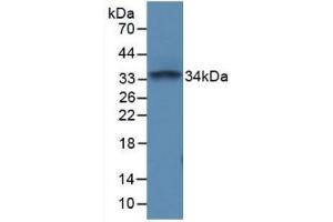 Detection of Recombinant PTPRC, Mouse using Polyclonal Antibody to Protein Tyrosine Phosphatase Receptor Type C (CD45) (CD45 anticorps  (AA 371-556))