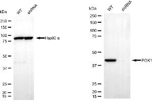 Western blotting analysis using phosphoglycerate kinase 1 antibody (ABIN7799809).