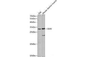 Western blot analysis of extracts of various cell lines using SSX5 Polyclonal Antibody at dilution of 1:1000. (SSX5 anticorps)